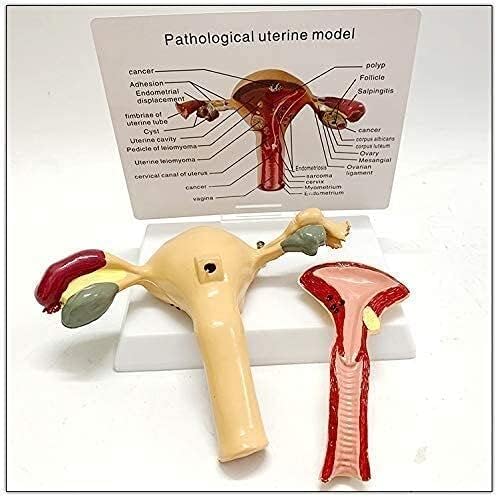 Model nastave, model ljudske anatomije, model materice i jajnika, anatomski Model ženskih reproduktivnih organa, anatomska anatomija